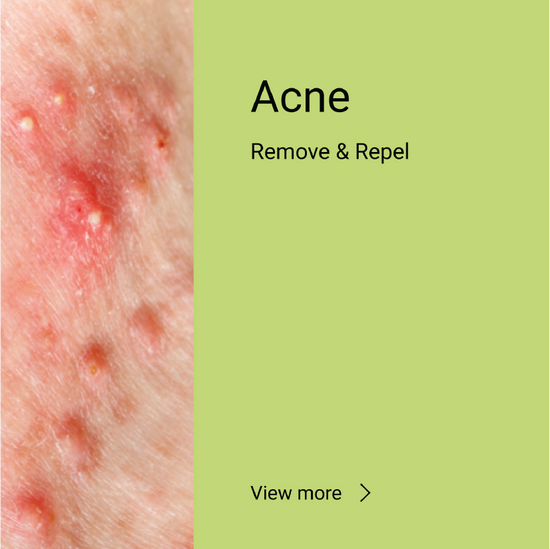 Acne <span>Remove & Repel</span>