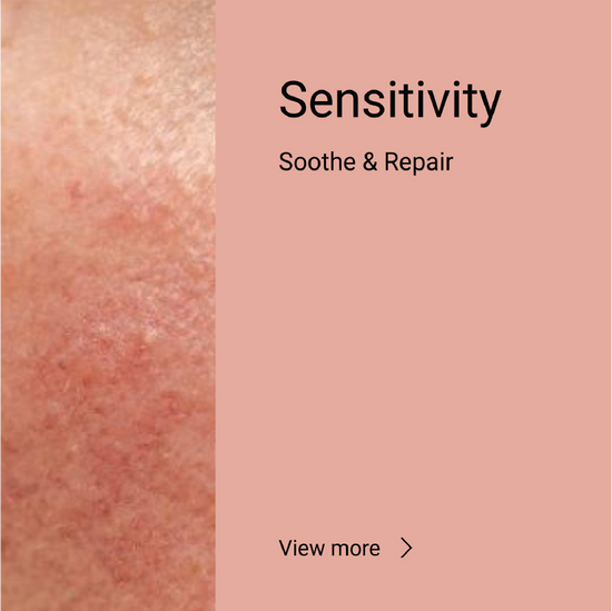 Sensitivity <span>Soothe & Repair</span>
